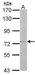Anti-IL17 Receptor D antibody [N3C2], Internal used in Western Blot (WB). GTX105688