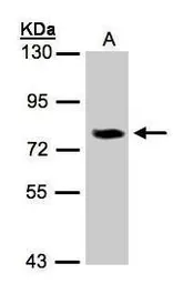 Anti-IL17 Receptor D antibody [N3C2], Internal used in Western Blot (WB). GTX105688