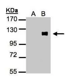 Anti-ZNF281 antibody [N1N3] used in Western Blot (WB). GTX105689