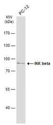 Anti-IKK beta antibody used in Western Blot (WB). GTX105690