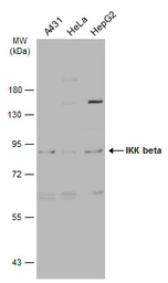 Anti-IKK beta antibody used in Western Blot (WB). GTX105690