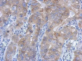 Anti-IKK beta antibody used in IHC (Paraffin sections) (IHC-P). GTX105690