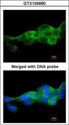 Anti-IKK beta antibody used in Immunocytochemistry/ Immunofluorescence (ICC/IF). GTX105690