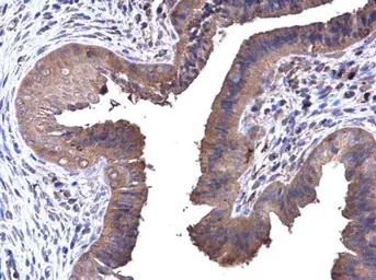 Anti-PFKL antibody [C1C3] used in IHC (Paraffin sections) (IHC-P). GTX105697