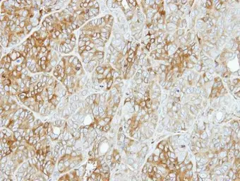 Anti-PFKL antibody [C1C3] used in IHC (Paraffin sections) (IHC-P). GTX105697