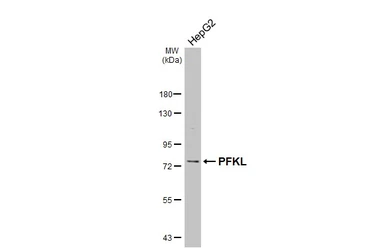 Anti-PFKL antibody [C1C3] used in Western Blot (WB). GTX105697