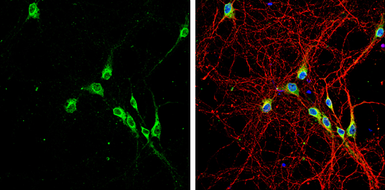 Anti-LGI1 antibody [N2C2], Internal used in Immunocytochemistry/ Immunofluorescence (ICC/IF). GTX105700