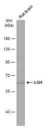 Anti-LGI1 antibody [N2C2], Internal used in Western Blot (WB). GTX105700
