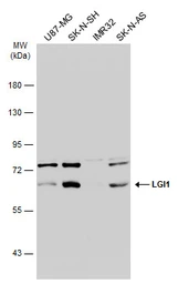 Anti-LGI1 antibody [N2C2], Internal used in Western Blot (WB). GTX105700