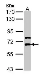 Anti-LGI1 antibody [N2C2], Internal used in Western Blot (WB). GTX105700