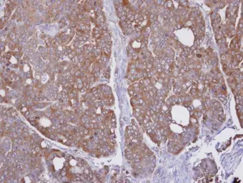 Anti-HAGH antibody [N2C3] used in IHC (Paraffin sections) (IHC-P). GTX105708