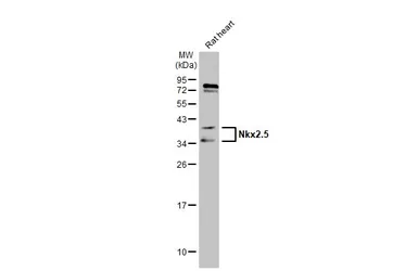 Anti-Nkx2.5 antibody used in Western Blot (WB). GTX105711