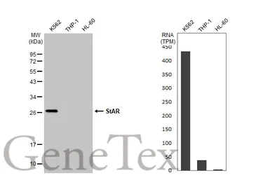Anti-StAR antibody used in Western Blot (WB). GTX105716