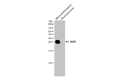 Anti-StAR antibody used in Western Blot (WB). GTX105716
