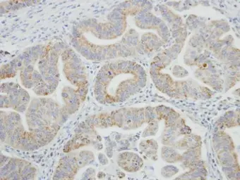 Anti-SRPR antibody [C1C3] used in IHC (Paraffin sections) (IHC-P). GTX105721