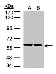 Anti-SRPR antibody [C1C3] used in Western Blot (WB). GTX105721