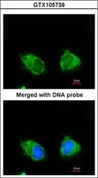Anti-INPP1 antibody [N1C2] used in Immunocytochemistry/ Immunofluorescence (ICC/IF). GTX105739