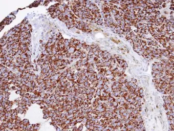 Anti-INPP1 antibody [N1C2] used in IHC (Paraffin sections) (IHC-P). GTX105739