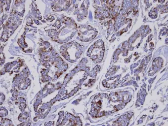 Anti-INPP1 antibody [N1C2] used in IHC (Paraffin sections) (IHC-P). GTX105739