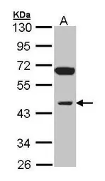 Anti-INPP1 antibody [N1C2] used in Western Blot (WB). GTX105739