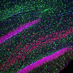 Anti-TDP43 antibody [3H8] used in IHC (Free Floating) (IHC (Free Floating)). GTX10574