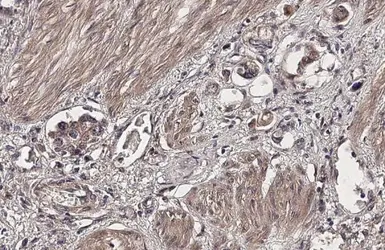 Anti-Nectin 2 antibody used in IHC (Paraffin sections) (IHC-P). GTX105742