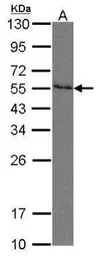 Anti-Nectin 2 antibody used in Western Blot (WB). GTX105742