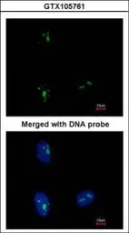 Anti-KRR1 antibody [N1C3] used in Immunocytochemistry/ Immunofluorescence (ICC/IF). GTX105761