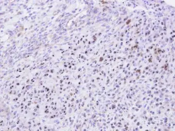 Anti-KRR1 antibody [N1C3] used in IHC (Paraffin sections) (IHC-P). GTX105761