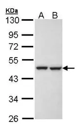 Anti-KRR1 antibody [N1C3] used in Western Blot (WB). GTX105761