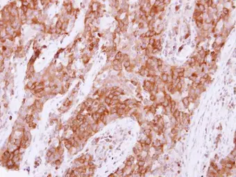 Anti-Pez antibody [C2C3], C-term used in IHC (Paraffin sections) (IHC-P). GTX105769