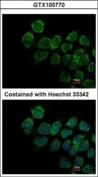 Anti-IFNAR2 antibody used in Immunocytochemistry/ Immunofluorescence (ICC/IF). GTX105770