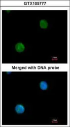 Anti-MYBPC2 antibody [N3C1], Internal used in Immunocytochemistry/ Immunofluorescence (ICC/IF). GTX105777