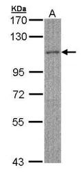 Anti-MYBPC2 antibody [N3C1], Internal used in Western Blot (WB). GTX105777