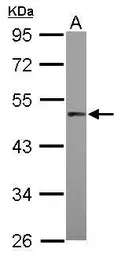 Anti-PRAK antibody [N1C1] used in Western Blot (WB). GTX105778
