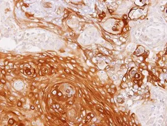 Anti-GBP1 antibody [N2C2], Internal used in IHC (Paraffin sections) (IHC-P). GTX105782