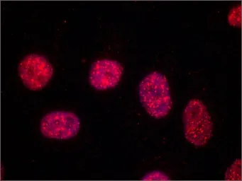 Anti-TRF1 antibody [TRF-78] used in Immunocytochemistry/ Immunofluorescence (ICC/IF). GTX10579