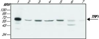 Anti-TRF1 antibody [TRF-78] used in Western Blot (WB). GTX10579