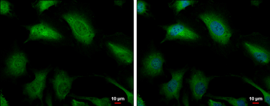 Anti-Glyoxalase I antibody [N1C3] used in Immunocytochemistry/ Immunofluorescence (ICC/IF). GTX105792
