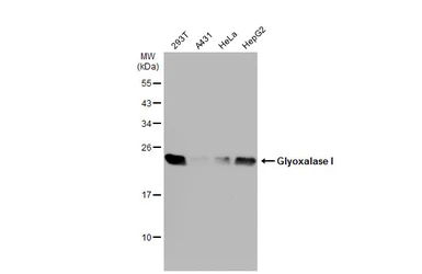 Anti-Glyoxalase I antibody [N1C3] used in Western Blot (WB). GTX105792