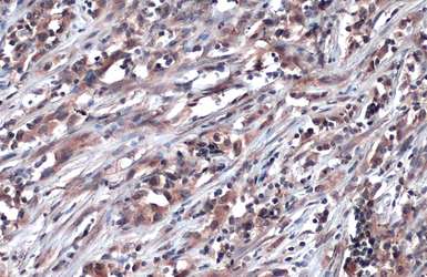 Anti-Glyoxalase I antibody [N1C3] used in IHC (Paraffin sections) (IHC-P). GTX105792