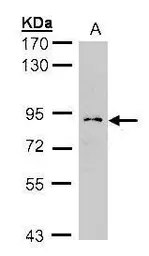 Anti-Glucosidase I antibody [N1N3] used in Western Blot (WB). GTX105798