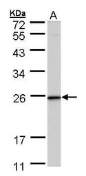 Anti-KLRG1 antibody [N1C3] used in Western Blot (WB). GTX105801