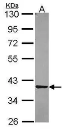 Anti-PIG3 antibody [N2C3] used in Western Blot (WB). GTX105821