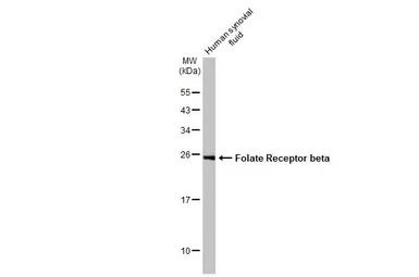 Anti-Folate Receptor beta antibody used in Western Blot (WB). GTX105822