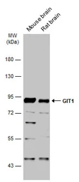 Anti-GIT1 antibody [N3C2], Internal used in Western Blot (WB). GTX105824