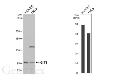 Anti-GIT1 antibody [N3C2], Internal used in Western Blot (WB). GTX105824