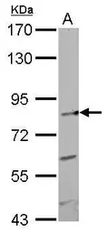 Anti-GIT1 antibody [N3C2], Internal used in Western Blot (WB). GTX105824