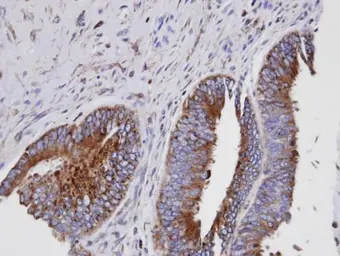 Anti-GIT1 antibody [N3C2], Internal used in IHC (Paraffin sections) (IHC-P). GTX105824