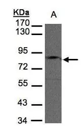 Anti-GIT1 antibody [N3C2], Internal used in Western Blot (WB). GTX105824